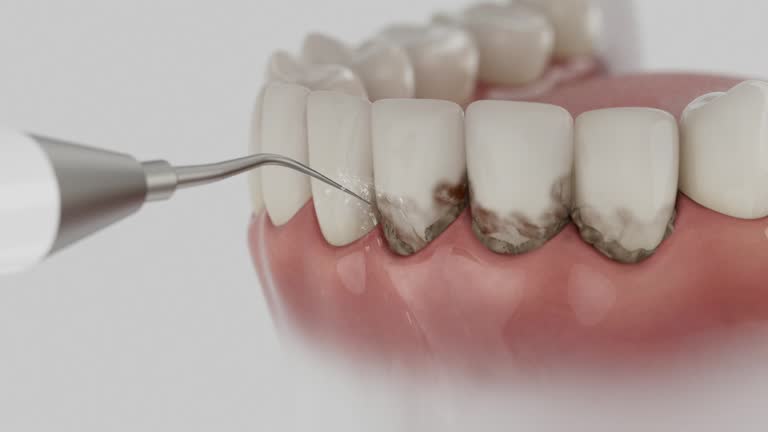 Reliable Dental contractor in Elk River, MN by Dentist Open Now
